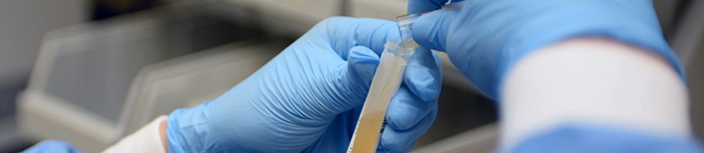 Médecine interne et maladie infectieuse