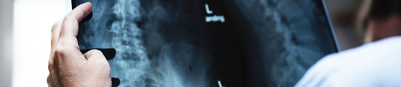 Radiologie, scanner, IRM